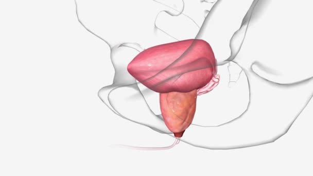 Hiperplasia Prostática Benigna Hpb Una Afección Cancerosa Que Próstata Agranda — Vídeos de Stock