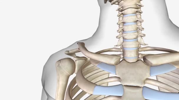 锁骨骨折是锁骨的骨折 锁骨是肩部的主要骨折之一 — 图库视频影像