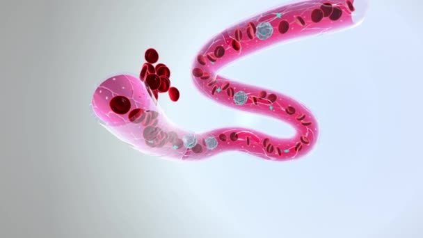 Hemofili Kanayan Taşıyıcı Tıbbi — Stok video