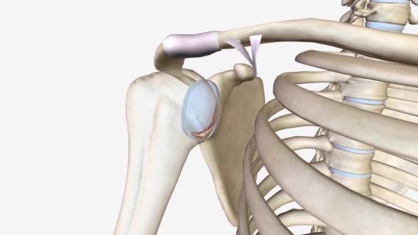 Bankart Lesion Occurs Result Forward Shoulder Dislocation — Stock Video
