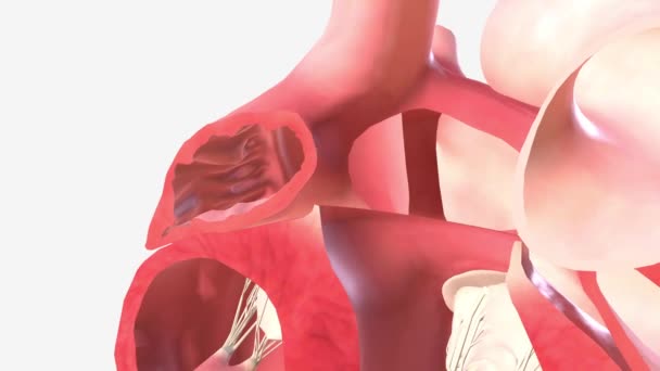 Une Anomalie Septale Auriculaire Est Une Anomalie Congénitale Cœur Dans — Video