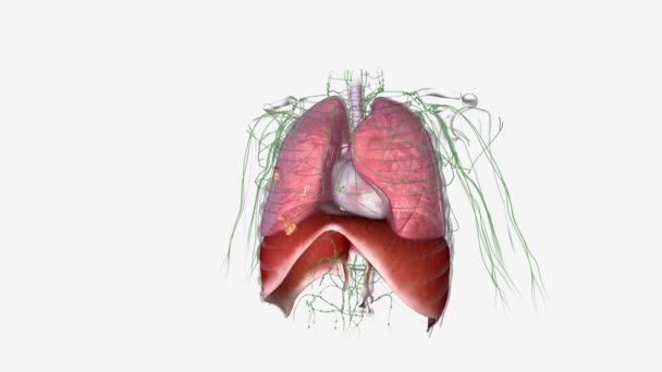 肺癌已达到3个阶段 已从肺部扩散到邻近的其他组织或远处的淋巴结 — 图库视频影像
