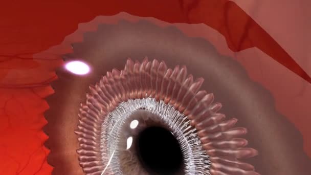 Blefaritida Běžné Oční Onemocnění Které Dělá Vaše Oční Víčka Červená — Stock video