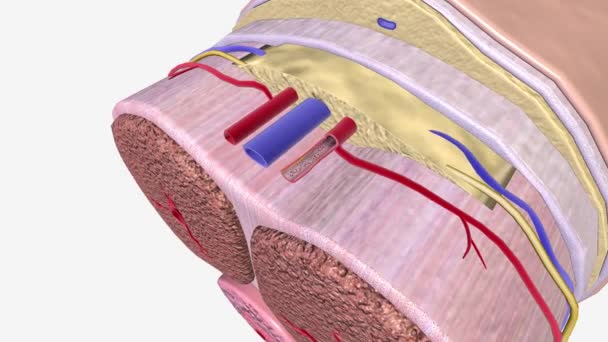 动脉粥样硬化是指动脉壁上的斑块堆积 — 图库视频影像
