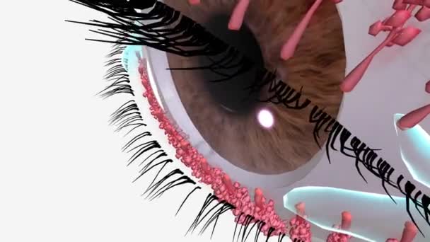 凝集于腺体中的硬化油导致眼睑周围发炎时 就会出现血友病和美宝症 — 图库视频影像
