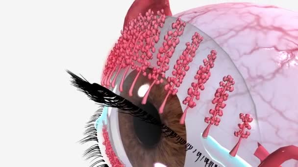 血友病是眼睑边缘的一种炎症 — 图库视频影像