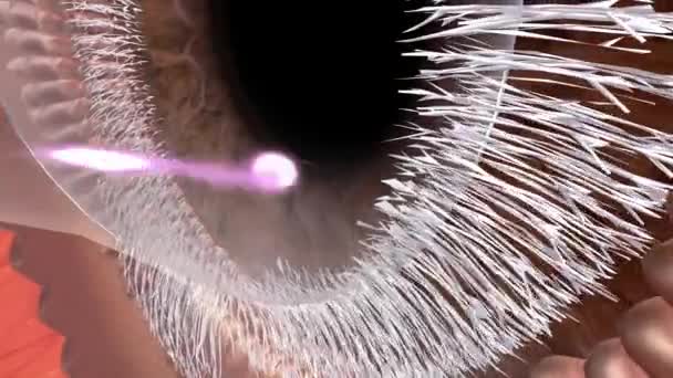 Βλεφαρίτιδα Είναι Μια Κοινή Πάθηση Των Ματιών Που Κάνει Βλέφαρά — Αρχείο Βίντεο