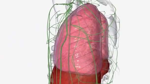 Tüdőrák Eléri Stádiumot Átterjedt Tüdőről Más Közeli Szövetekre Vagy Távoli — Stock videók