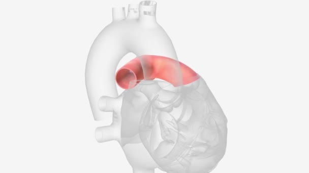 肺トランクは 心臓から肺に解毒された血液を輸送する短い動脈です — ストック動画