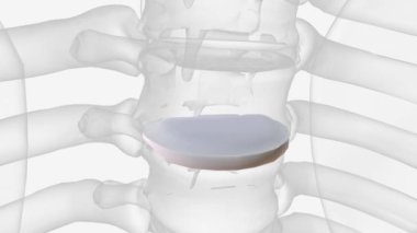 Intervertebral disc of T4 vertebra .