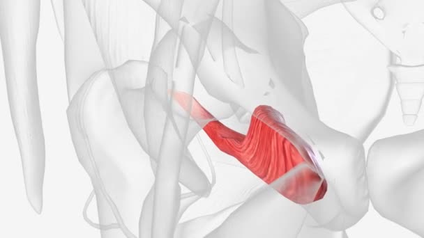 阻塞器外植入物 股骨大转子的后子宫表面 — 图库视频影像
