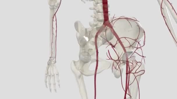 Arteri Iliac Eksternal Adalah Suplai Darah Utama Tungkai Bawah Karena — Stok Video