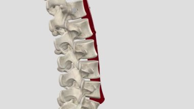 Abdominal aort anevrizması, vücudun ana atardamarının alt kısmında, aort adı verilen genişletilmiş bir alandır.