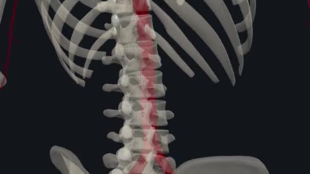 腹部動脈瘤は 身体の主要な動脈の下部に拡大された領域です — ストック動画