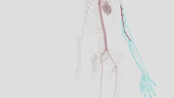 Kol Atardamarı Aksiller Arterin Alt Kısmından Başlayan Ana Kas Atardamarının — Stok video