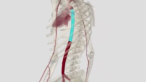 Aneurisma Aorta Perut Adalah Daerah Yang Diperbesar Bagian Bawah Arteri — Stok Video