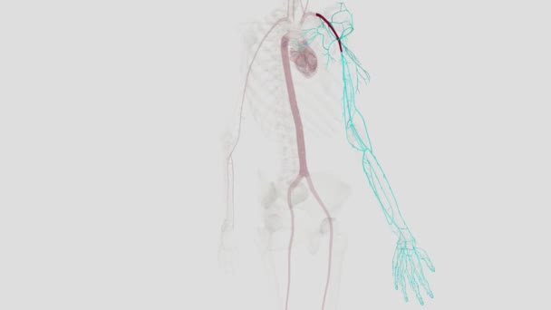 Artéria Axilar Grande Vaso Muscular Que Atravessa Axila — Vídeo de Stock
