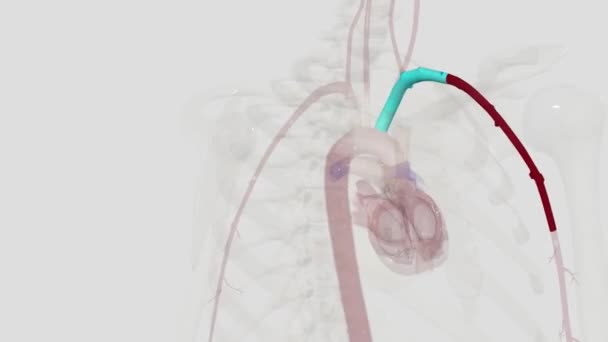 Arteria Axilar Gran Vaso Muscular Que Viaja Través Axila — Vídeos de Stock