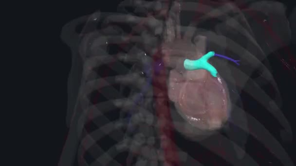 Artéria Pulmonar Direita Cursa Posterior Aorta Ascendente Anterior Aorta Descendente — Vídeo de Stock
