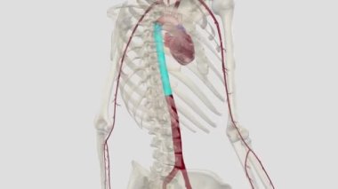 Abdominal aort anevrizması, vücudun ana atardamarının alt kısmında, aort adı verilen genişletilmiş bir alandır.