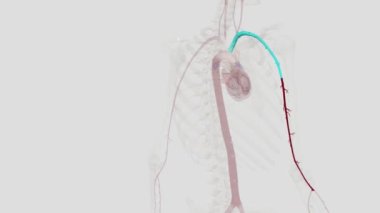 Kol atardamarı aksiller arterin alt kısmından başlayan ana kas atardamarının uzantısıdır.