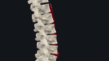 Abdominal aort anevrizması, vücudun ana atardamarının alt kısmında, aort adı verilen genişletilmiş bir alandır.