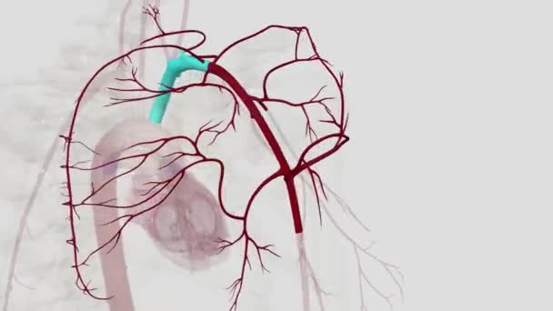 Треракоакроміальна Артерія Виділяє Чотири Гілки Забезпечення Язів Шкіри Грудної Клітини — стокове відео