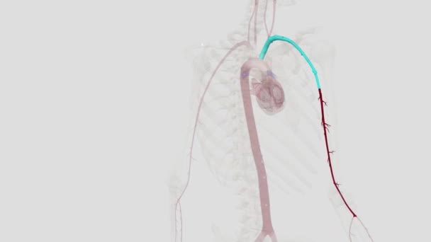 Artera Brahială Este Extensia Arterei Axilare Începând Marginea Inferioară Mușchiului — Videoclip de stoc