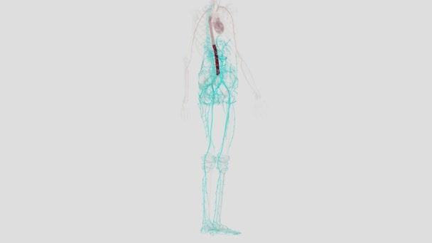 Abdominal Aort Anevrizması Vücudun Ana Atardamarının Alt Kısmında Aort Adı — Stok video