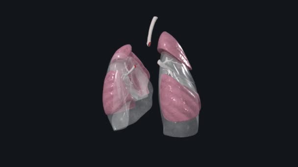 左肺侧侧基底段支气管 — 图库视频影像