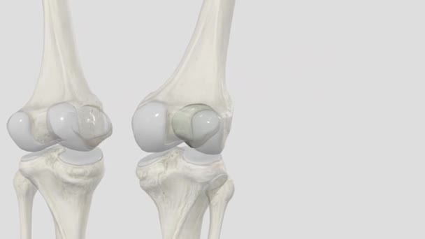 Patella Your Kneecap Bone Front Your Knee Joint — Stock Video