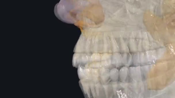 面颊脂肪垫 也被称为Bichat的脂肪垫 — 图库视频影像