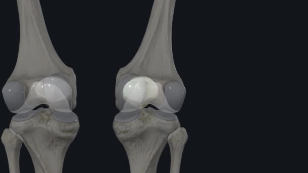 Patella Adalah Tempurung Lututmu Ini Adalah Tulang Bagian Depan Lutut — Stok Video