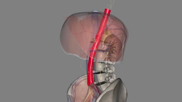 腹主动脉瘤是身体主动脉下部的一个扩大区域 称为主动脉 — 图库视频影像
