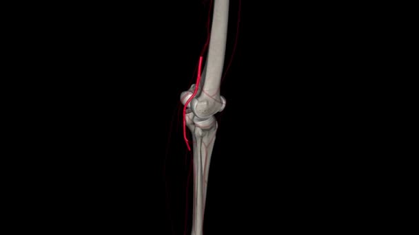 小腿动脉是腿的主要动脉之一 它是股动脉的延续 — 图库视频影像