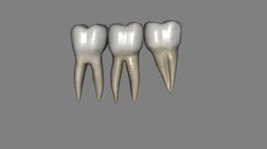 Alt çenenin ilk azı dişinin genellikle iki kökü vardır, bir kemik ve bir distal. .