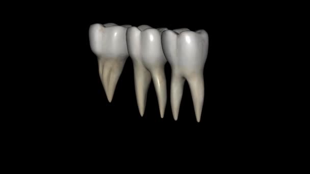 下颌第一磨牙通常有两个根 一个是近牙 另一个是远牙 — 图库视频影像