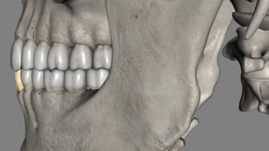 Mandibular köpek dişinin iki alt çenenin ön dişlerinden ve iki alt çenenin ön dişlerinden uzak olarak yerleştirilmiş olmasıdır.