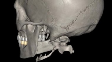 Alt çenenin ilk azı dişinin genellikle iki kökü vardır, bir kemik ve bir distal. .