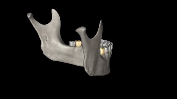Mandibular Second Molar Resembles Mandibular First Permanent Molar Primary Tooth — Stock Video