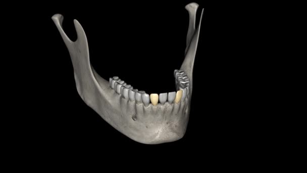 横側の切開口部は 口の中央切開の両方から遠く離れた場所に位置する歯であり 両方のマンデブリカインから回復している — ストック動画