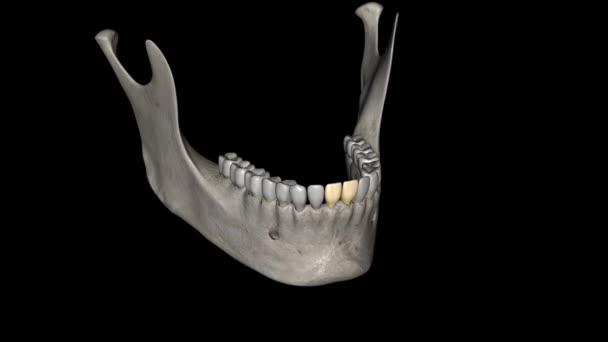 Mandibular Central Incisor Tooth Located Jaw Adjacent Midline Face — Stock Video
