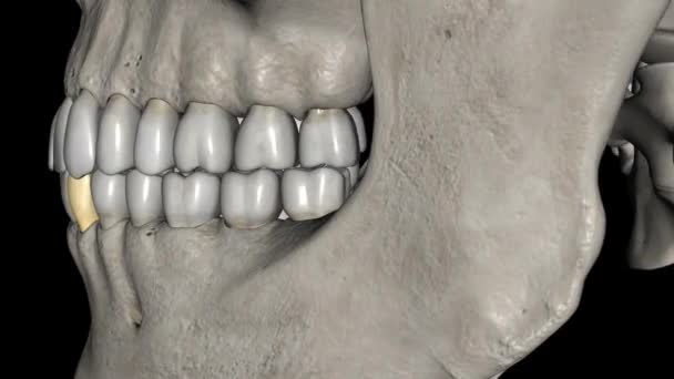 マンボリュームカニンは 口の義務的な後頭痛の両方から遠くに位置する歯ですが マンボリュームの最初の前提の両方から — ストック動画