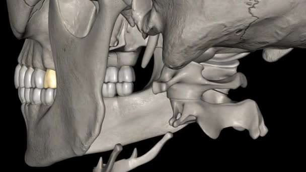 Segundo Molar Superior Dente Localizado Distalmente Ambos Primeiros Molares Superiores — Vídeo de Stock