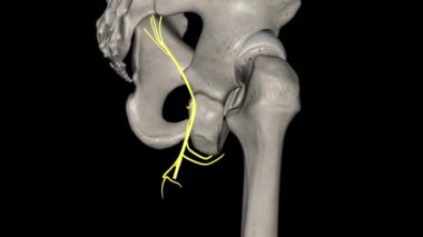 Posterior femoral derimsi sinir 3D