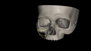 Yüz sinirlerinin elmacık kemiği dalları (sıtma dalları) yüzün sinirleridir. .