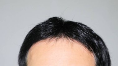 İnce saçlı bir Japon.