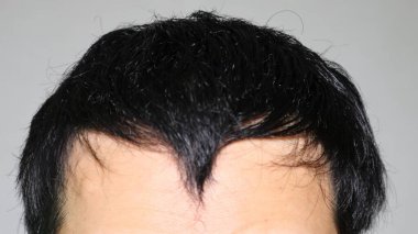 İnce saçlı bir Japon.