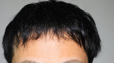 İnce saçlı bir Japon.