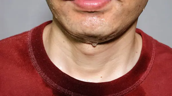 Close-up of a person sweating profusely